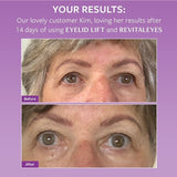 REVITALEYES