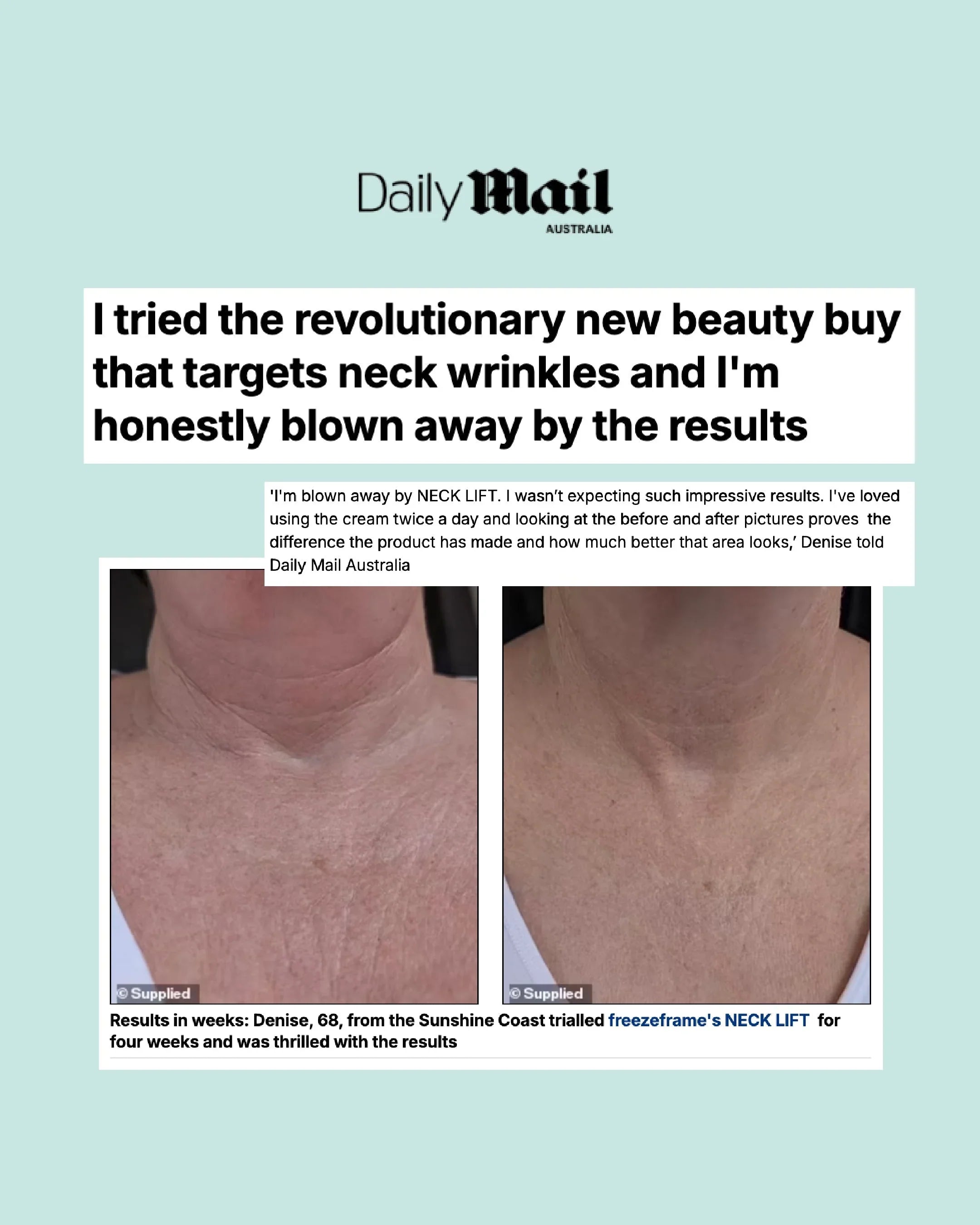 NECKLIFT as featured in Daily mail
