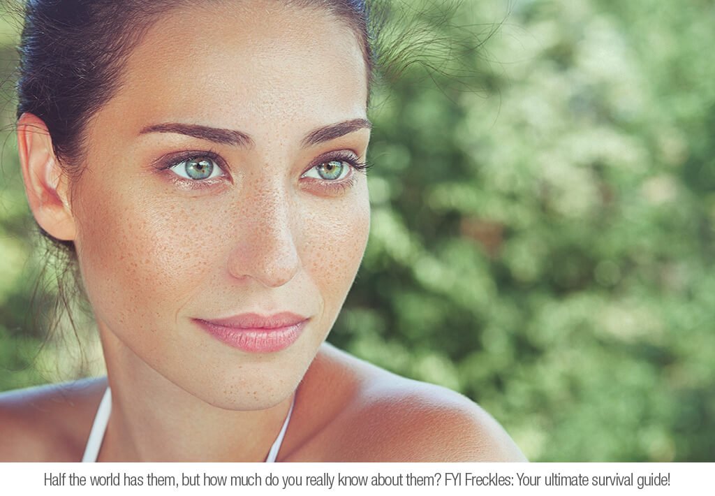 FYI – FRECKLES