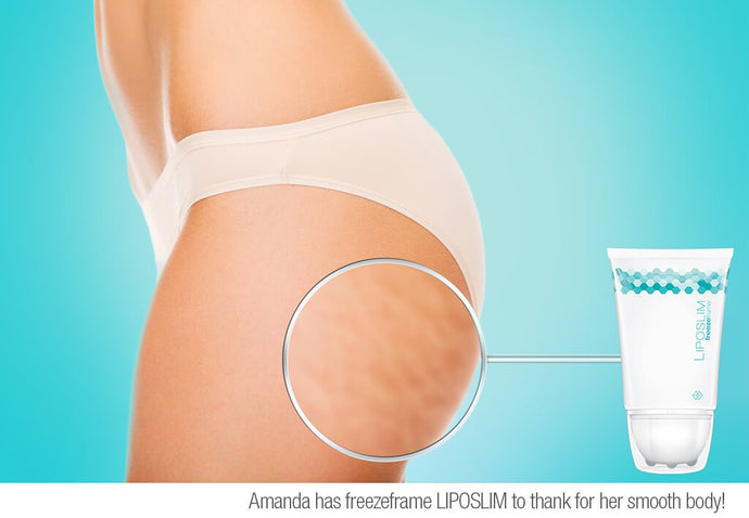 ANTI-CELLULITE MIRACLE