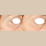 PRO-COLLAGEN SUNCEUTICAL