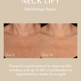New NECK LIFT