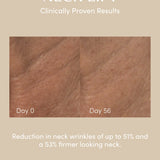 New NECK LIFT