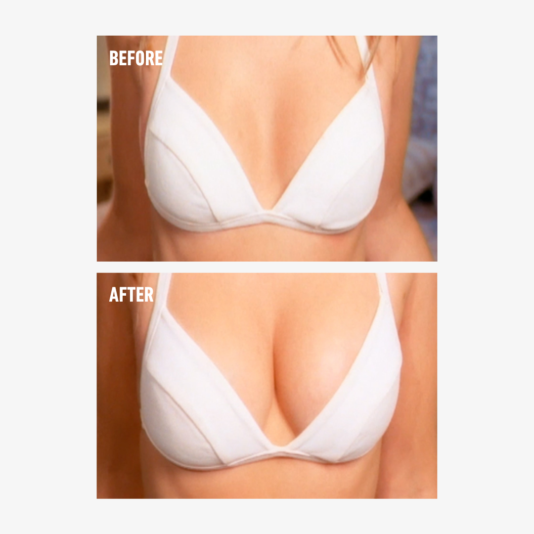 freezeframe BREAST ENHANCER before and after comparison showing a woman wearing a white bra, with visibly fuller, more lifted-looking breasts and enhanced cleavage in the after image.