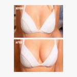 freezeframe BREAST ENHANCER before and after comparison showing a woman wearing a white bra, with visibly fuller, more lifted-looking breasts and enhanced cleavage in the after image.