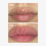 freezeframe LIP INJECTION before and after comparison showing a close-up of lips with visibly fuller-looking volume and a more defined appearance in the after image.