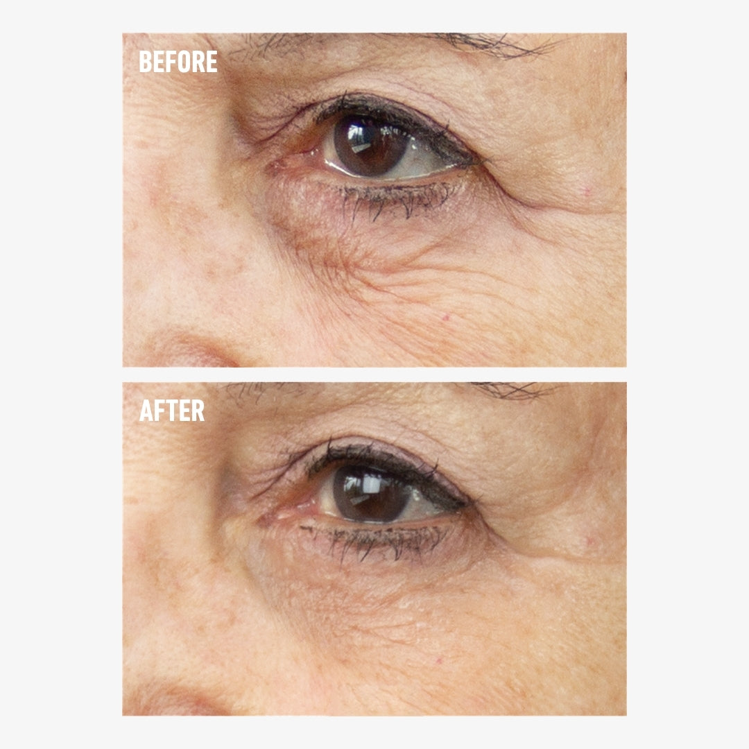 freezeframe REVITALEYES before and after eye cream results showing a close-up of the under-eye area with visibly smoother skin, reduced fine lines and less prominent crow's feet in the after image.