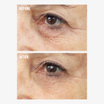 freezeframe REVITALEYES before and after eye cream results showing a close-up of the under-eye area with visibly smoother skin, reduced fine lines and less prominent crow's feet in the after image.