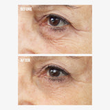 freezeframe REVITALEYES before and after eye cream results showing a close-up of the under-eye area with visibly smoother skin, reduced fine lines and less prominent crow's feet in the after image.