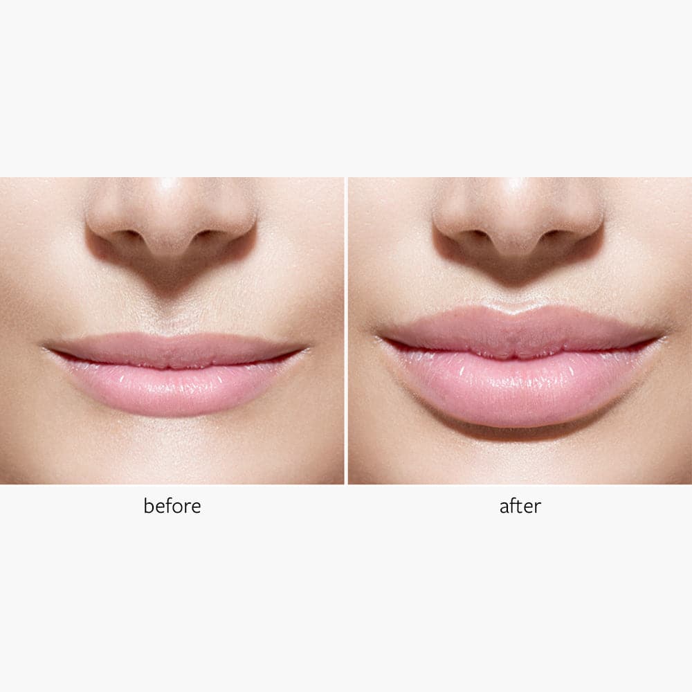 LIP INJECTION 10ml Freeze Frame freezeframeuk